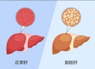 男性健康知识 -肝脏