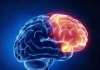 脑梗有后有哪些常见的后遗症？